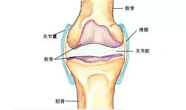 膝盖肿痛，关节里有积液，很可能是患上了滑膜炎，该如何治疗？