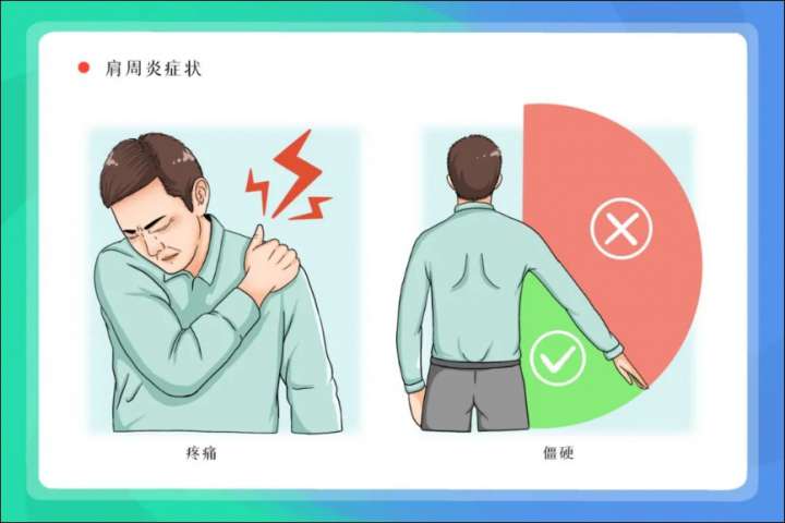 肩痛≠肩周炎，来测测你是哪一种？