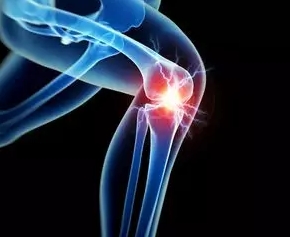 专家支招|膝关节置换术后多久可以下地活动