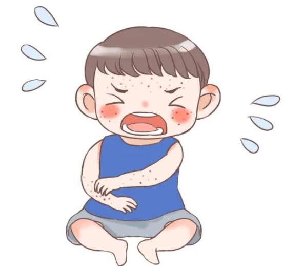 中医科普|王莒生教授治疗湿疹系列之婴儿湿疹