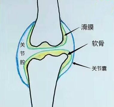 膝关节滑膜炎从何而来？又该如何消除？