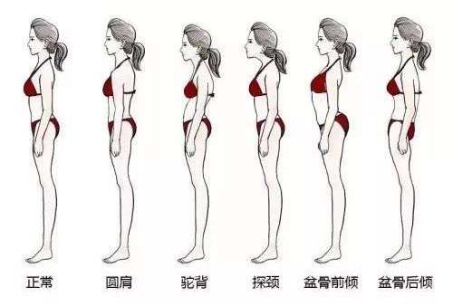 这个动作做不到位，说明你的骨盆前倾了！