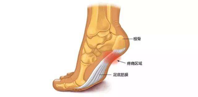 脚疼是怎么回事？不同位置疼痛的原因不同，这篇文章都说全了
