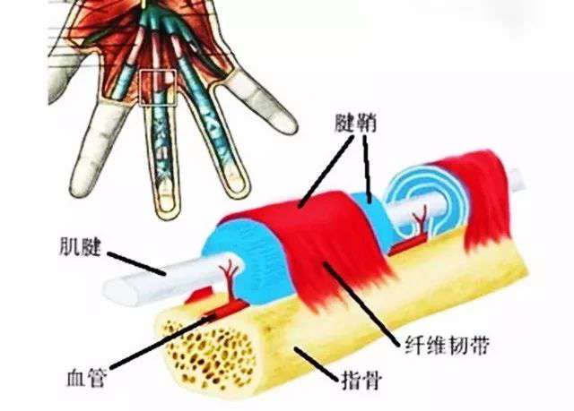 手指疼不灵活，有时卡住不能动，治疗其实很简单！
