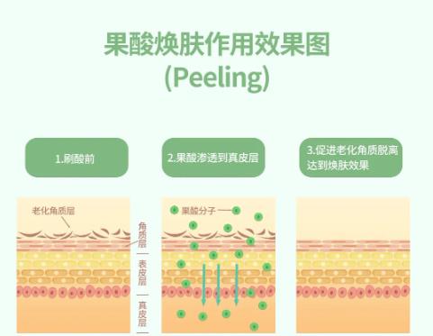 科普|“刷酸”为什么要到医院做？
