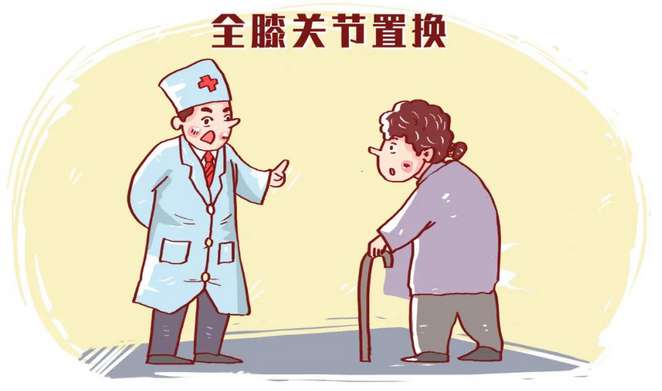 专家支招|全膝关节置换就是换掉整个“膝盖”吗
