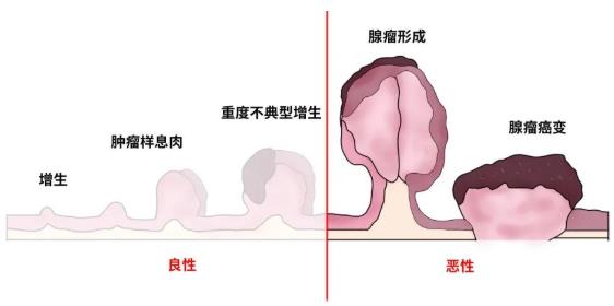 筛查消化道早癌，胃肠镜检查是“金手段”！