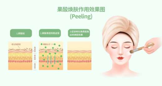 科普|在家自己刷酸？不是刷个寂寞，就是刷出危险！