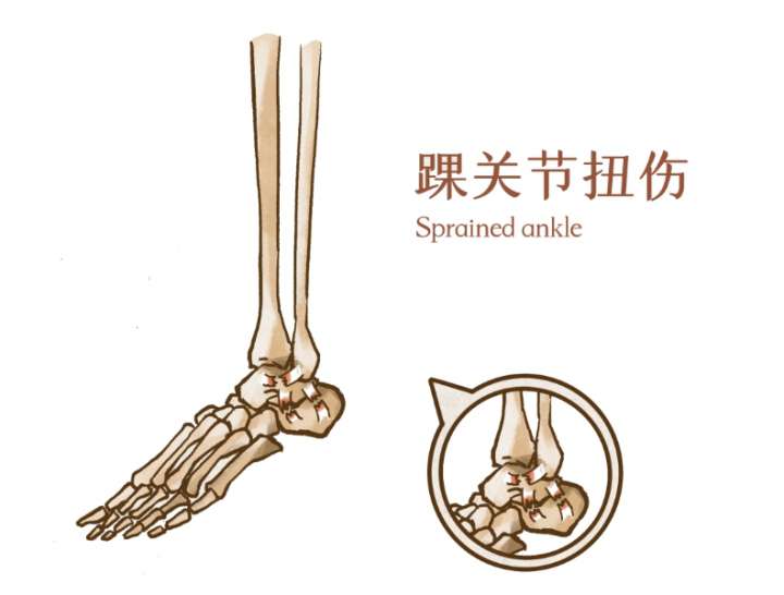 梅西转会大巴黎 运动医学专家怎么说