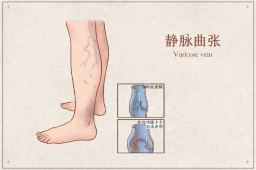 如何科学运动对膝盖更有益？