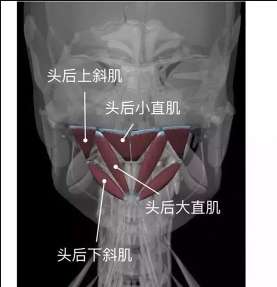 颈椎病引起的头疼太难受，用一个网球来解决，当时做，当时就缓解！
