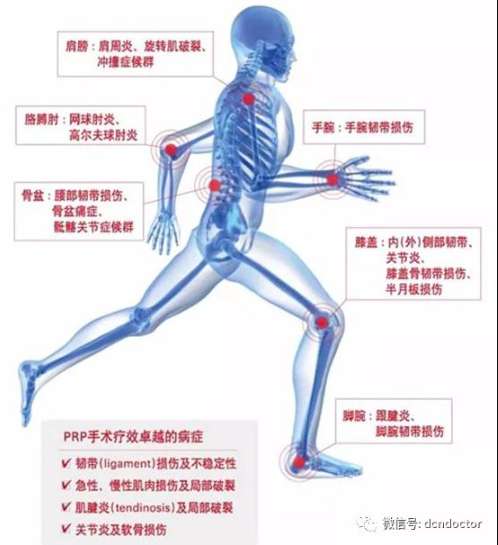 抽点血就能解决骨科疼痛，这个方法可以试一试！
