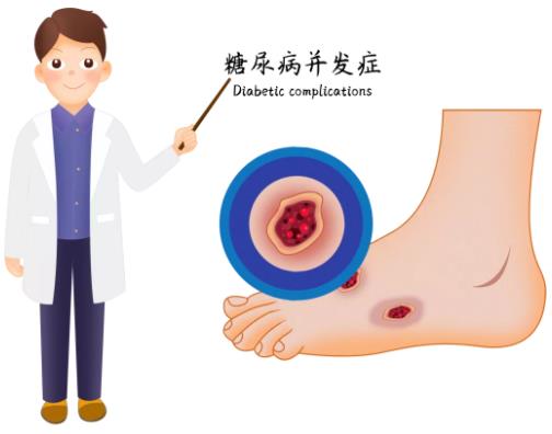 糖尿病患者快看看你的脚！