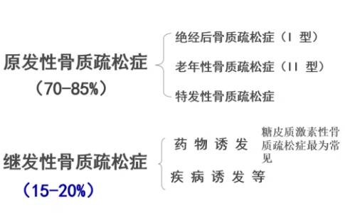 诊断有妙招――教你一分钟确认自己是否有骨质疏松症