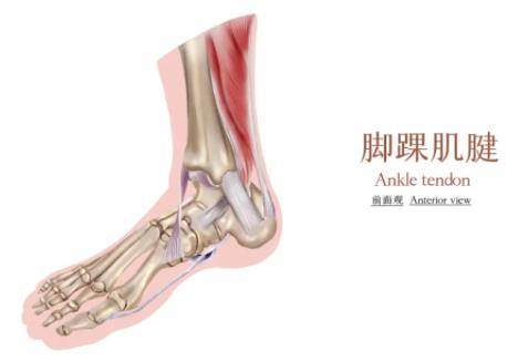 脚踝扭伤推着进去走着出来，前后不过3分钟