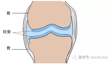 软骨是关节的命根子，如何运动才能保护关节软骨？