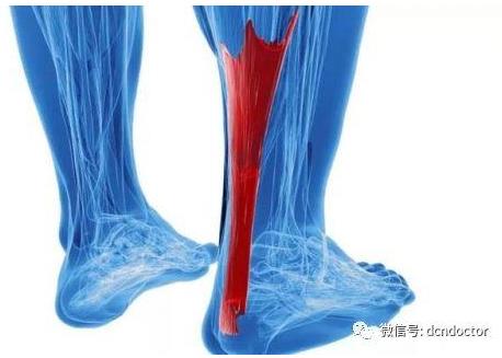 跟腱损伤是如何发生的？发生了应该怎么办？