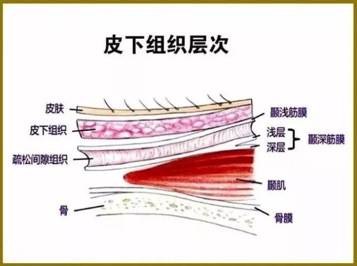 什么是筋膜炎？