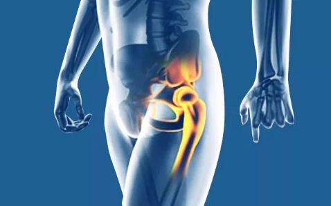 下蹲、弯腰、抬腿时髋关节疼，很可能是这个病