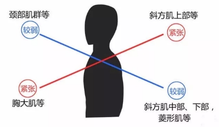 改善圆肩驼背、脖子前倾，这几个方法试过的都说好