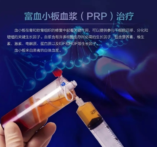 膝关节炎严重了只能换关节？这位医生始终将“保膝”作为第一治疗！