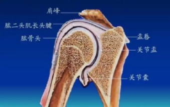肩膀一用力就脱臼，是怎么回事？