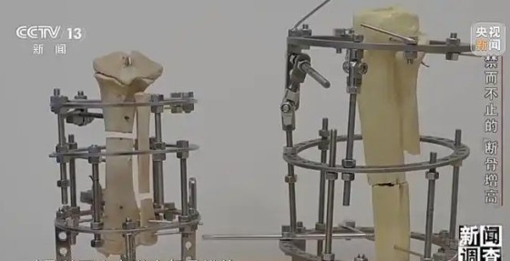 畸形审美暗藏健康隐患