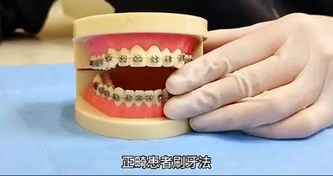 正畸宣教